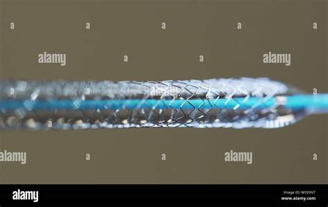 metal stent testing